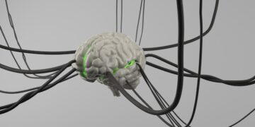 AI-assisted brain-computer interface lets a paralyzed man operate a robotic arm