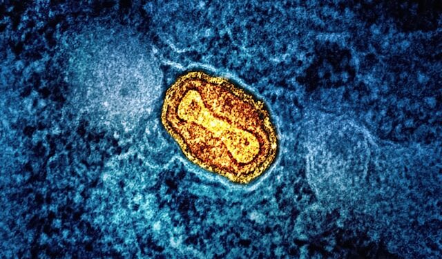 Why Neural Networks Are Metaphors, Not Neurons